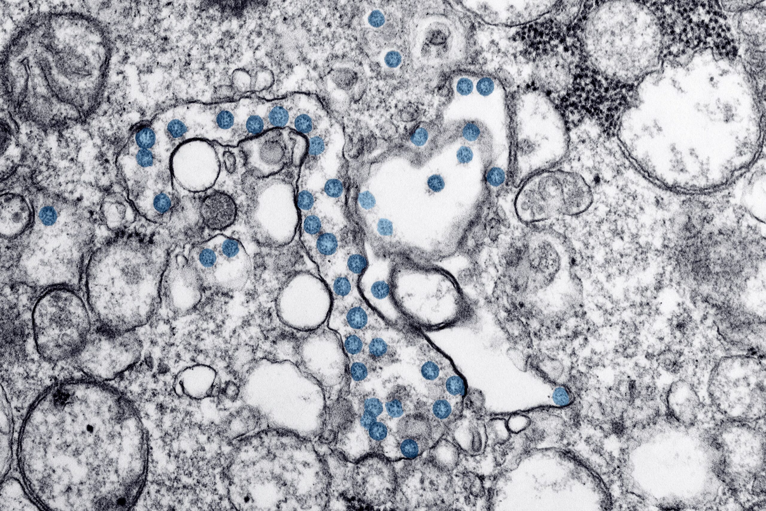 Microscopic illustration myelin sheath repair multiple sclerosis