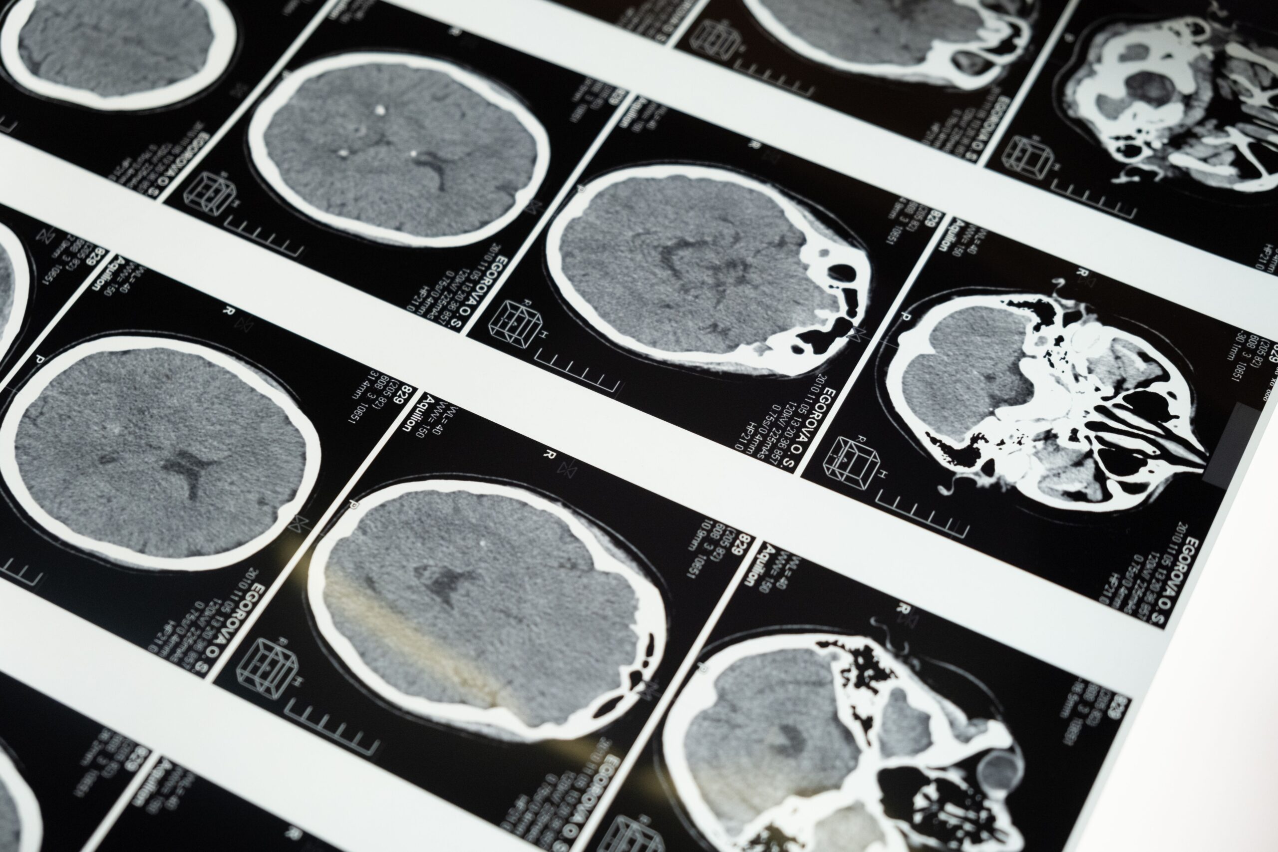 Brain scan illustration deception trust