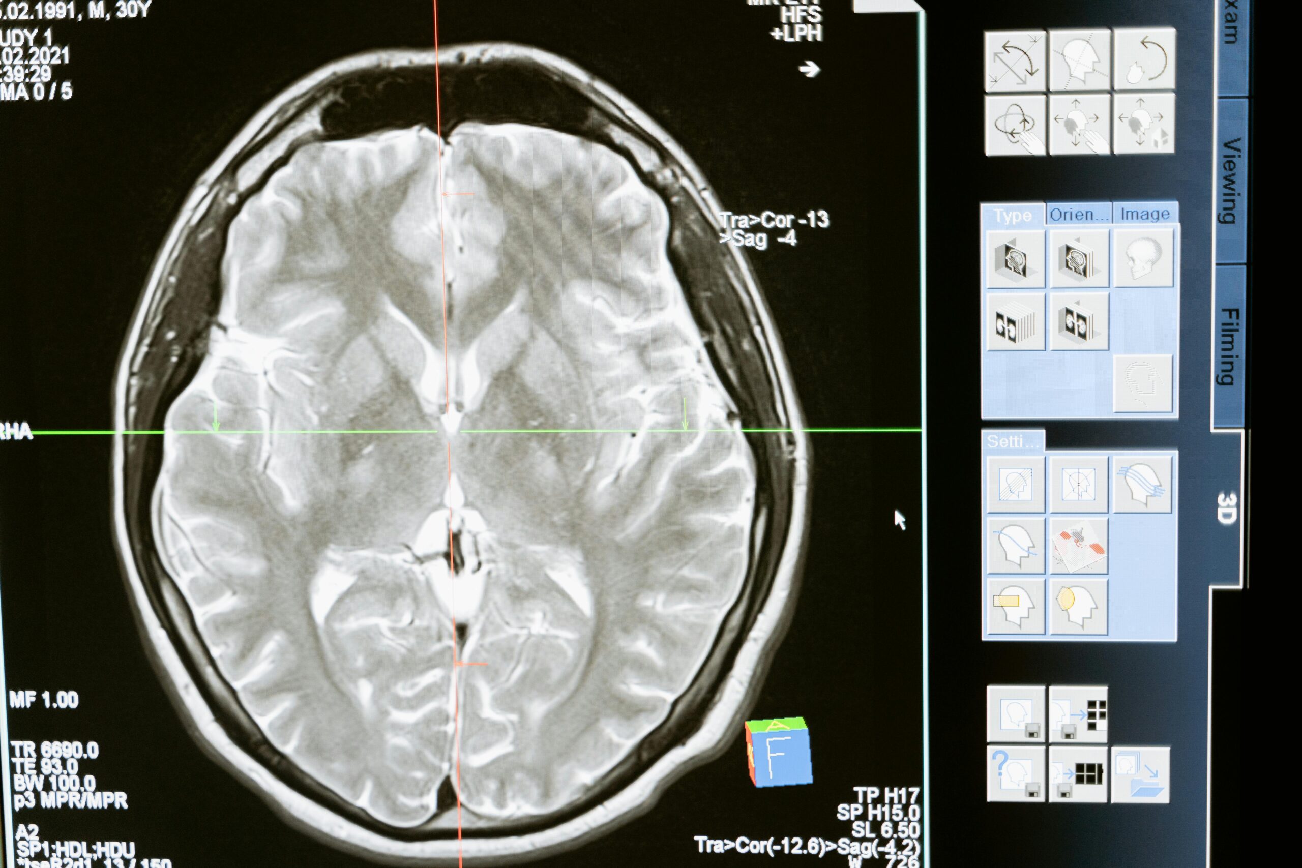 Brain connectivity mri network diagram